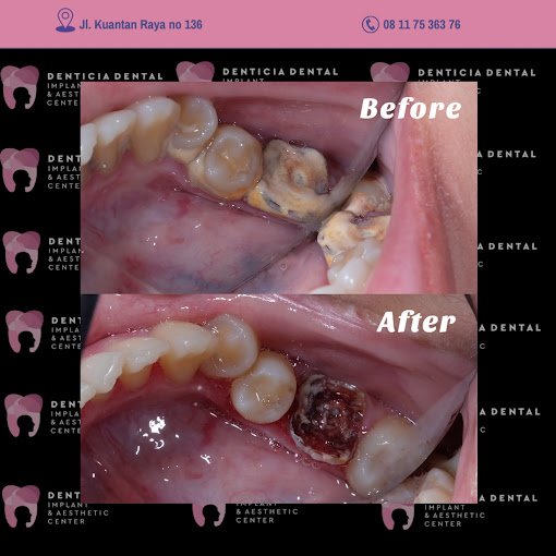 Before-After Gigi_3